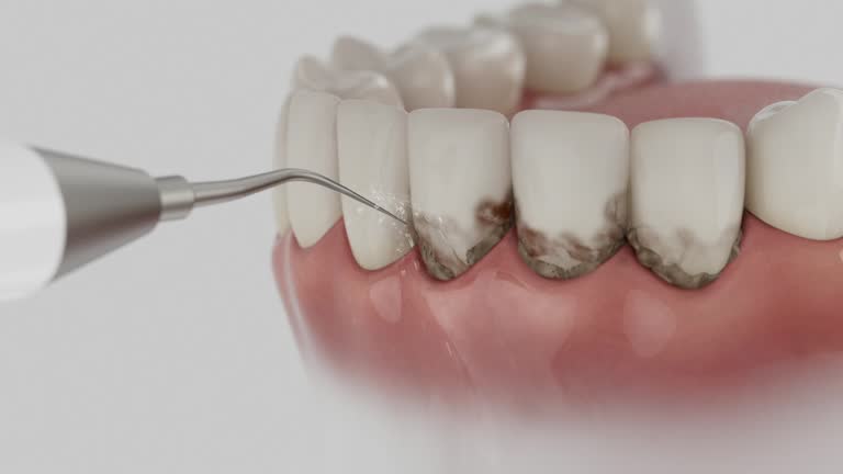 Reliable Teeth Cleaning And Checkup contractor in Charles Mix County County, SD by Dentist Open Now